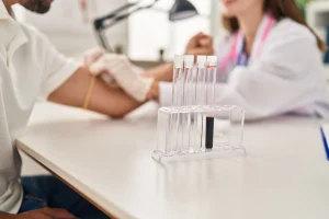 blood-sample-collection-for-a-cbc-test-showing-laboratory-tubes-used-to-determine-cbc-normal-range-by-age-and-gender