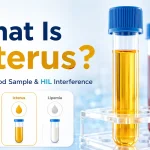 icteric blood sample with yellow serum tube showing hil interference in lab testing