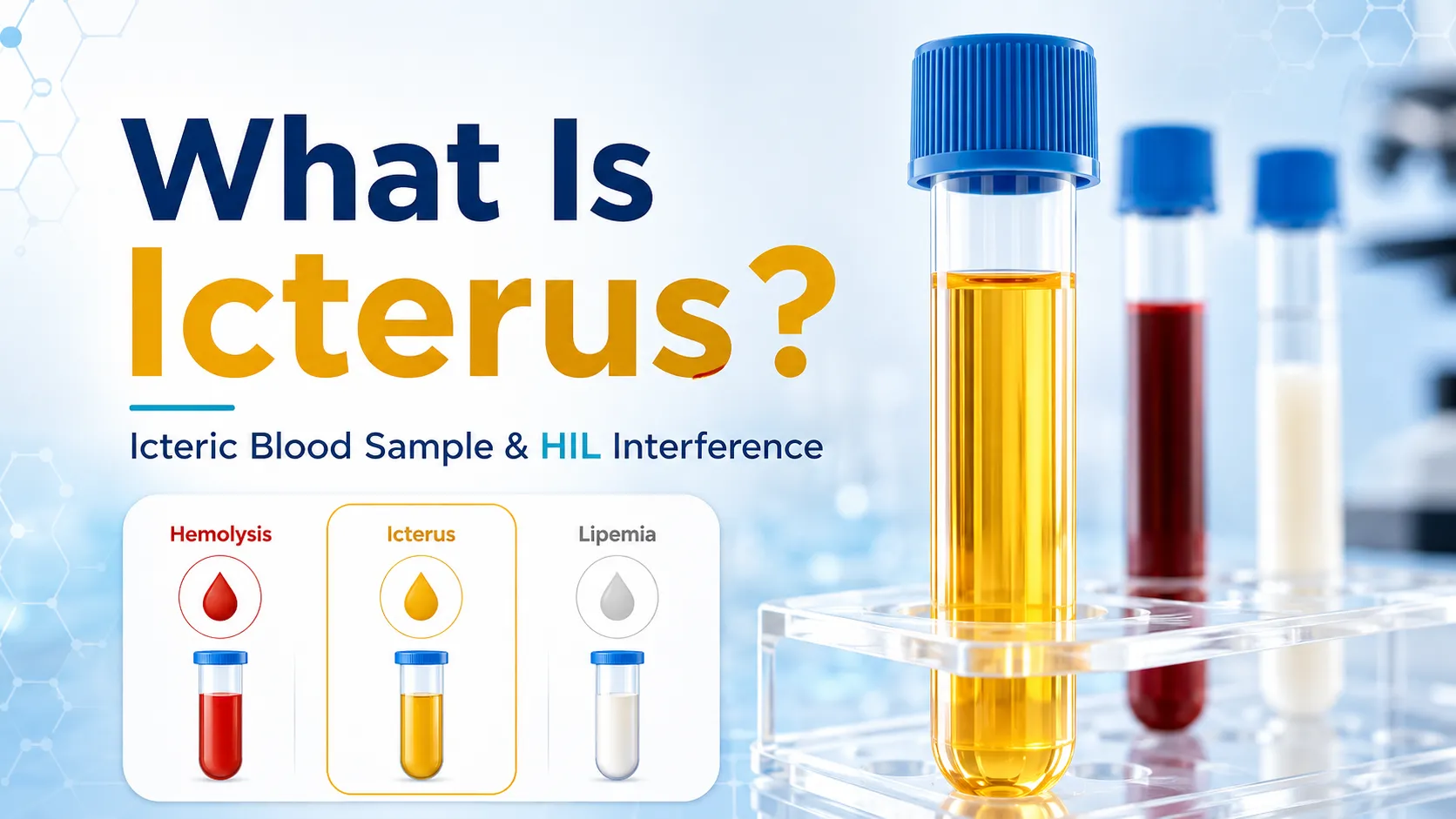 What is Icterus? Guide to Icteric Blood Sample & HIL Interference